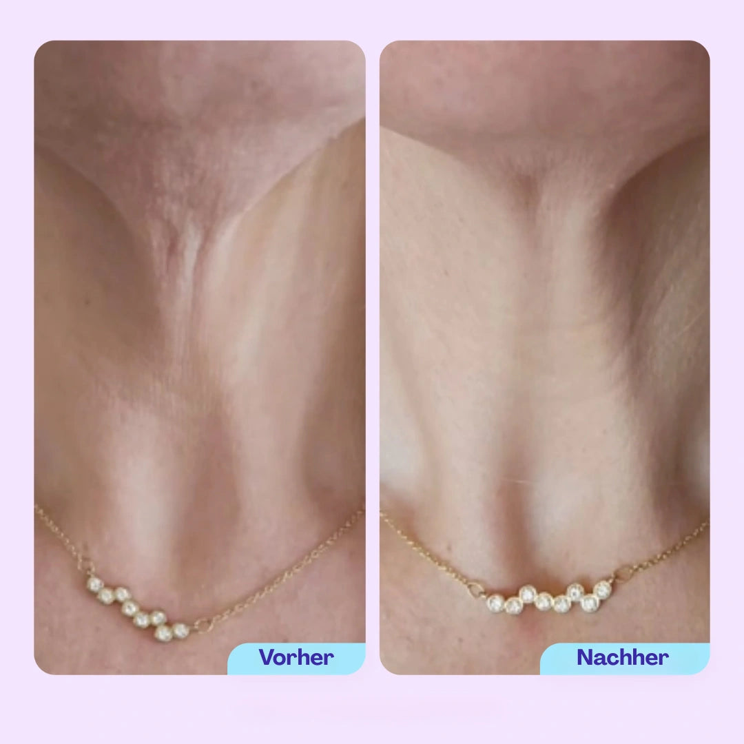 N-Lift Halscreme – Straffere Haut am Hals & Dekolleté