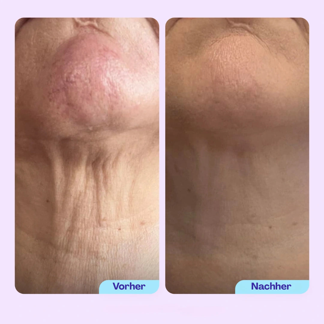 N-Lift Halscreme – Straffere Haut am Hals & Dekolleté