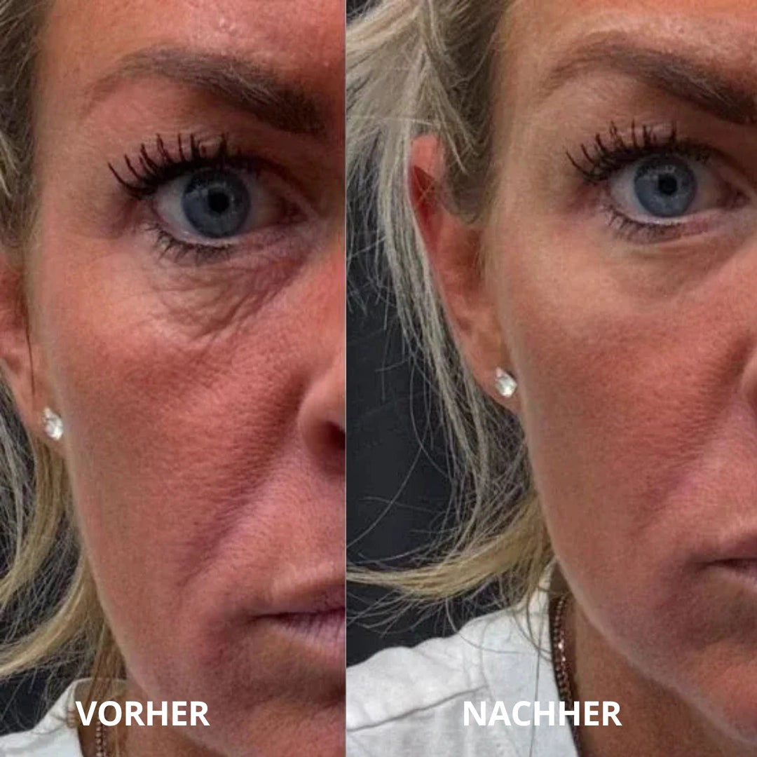 Peptid-Kollagen Hydrogel-Augenpads