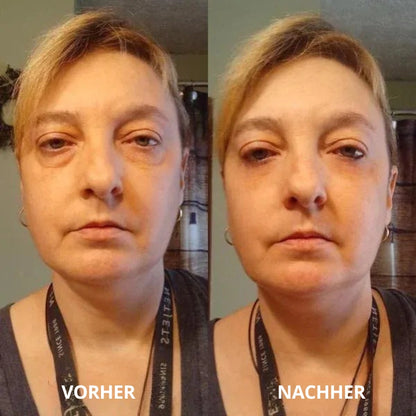 Peptid-Kollagen Hydrogel-Augenpads