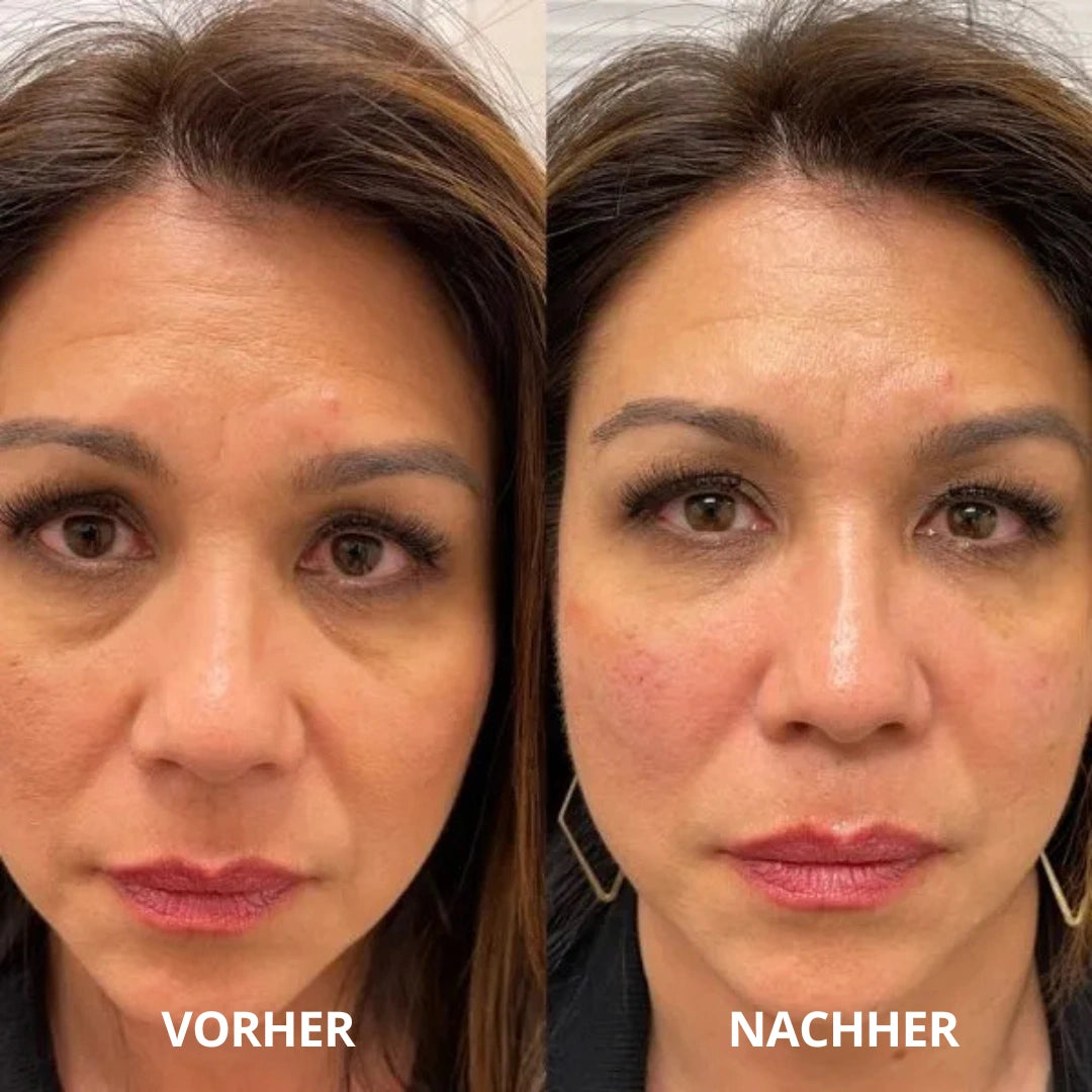 Peptid-Kollagen Hydrogel-Augenpads