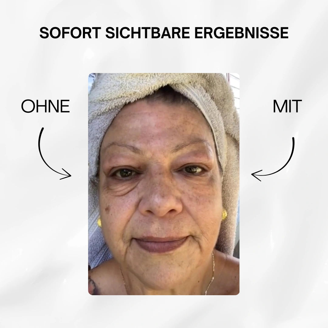 V-Lift Augencreme – Sofort straffer aussehen