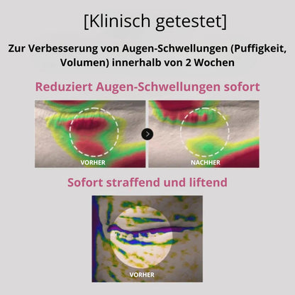 Peptid-Kollagen Hydrogel-Augenpads