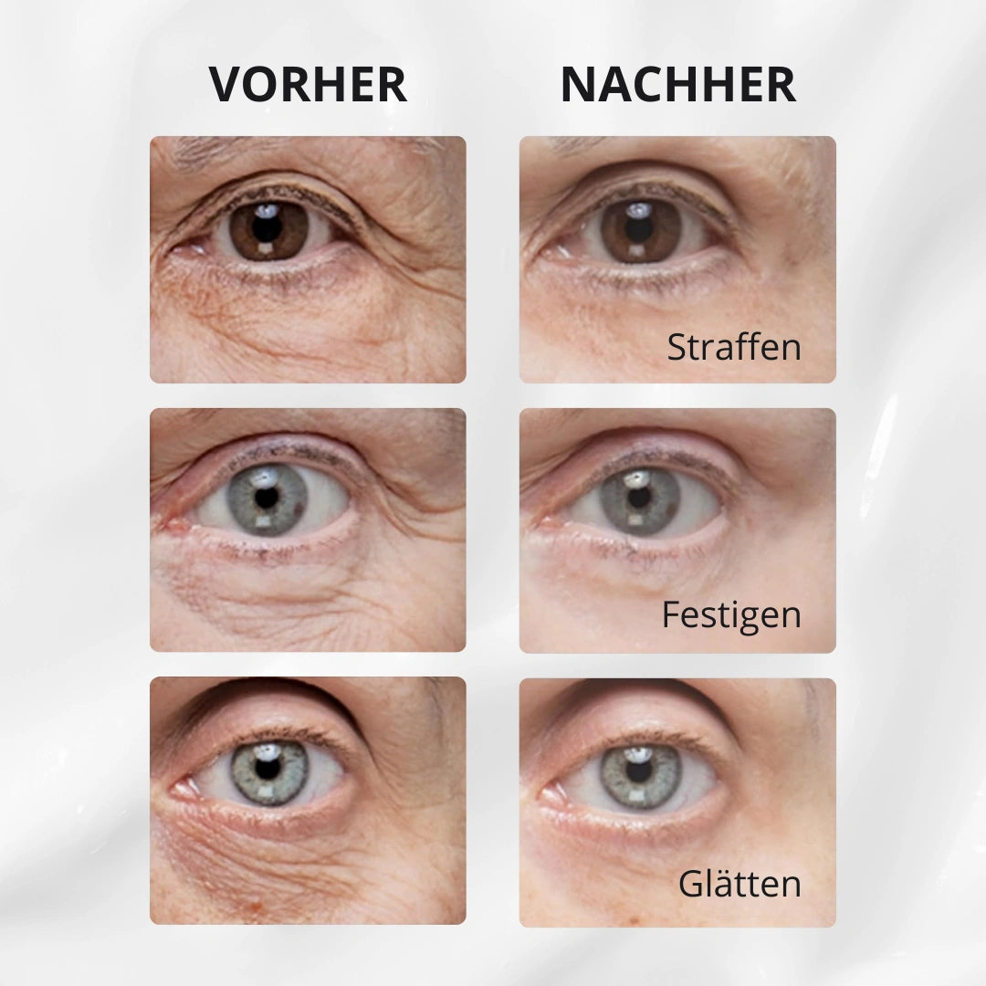 V-Lift Augencreme – Sofort straffer aussehen