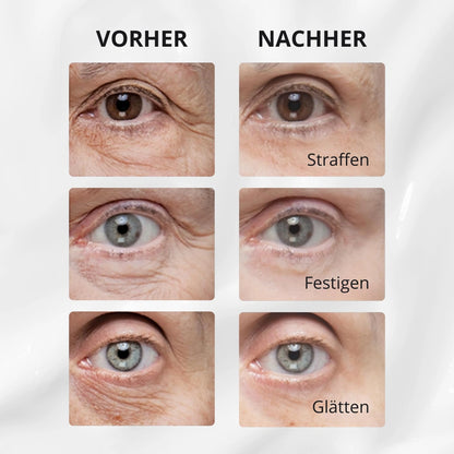 V-Lift Augencreme – Sofort straffer aussehen