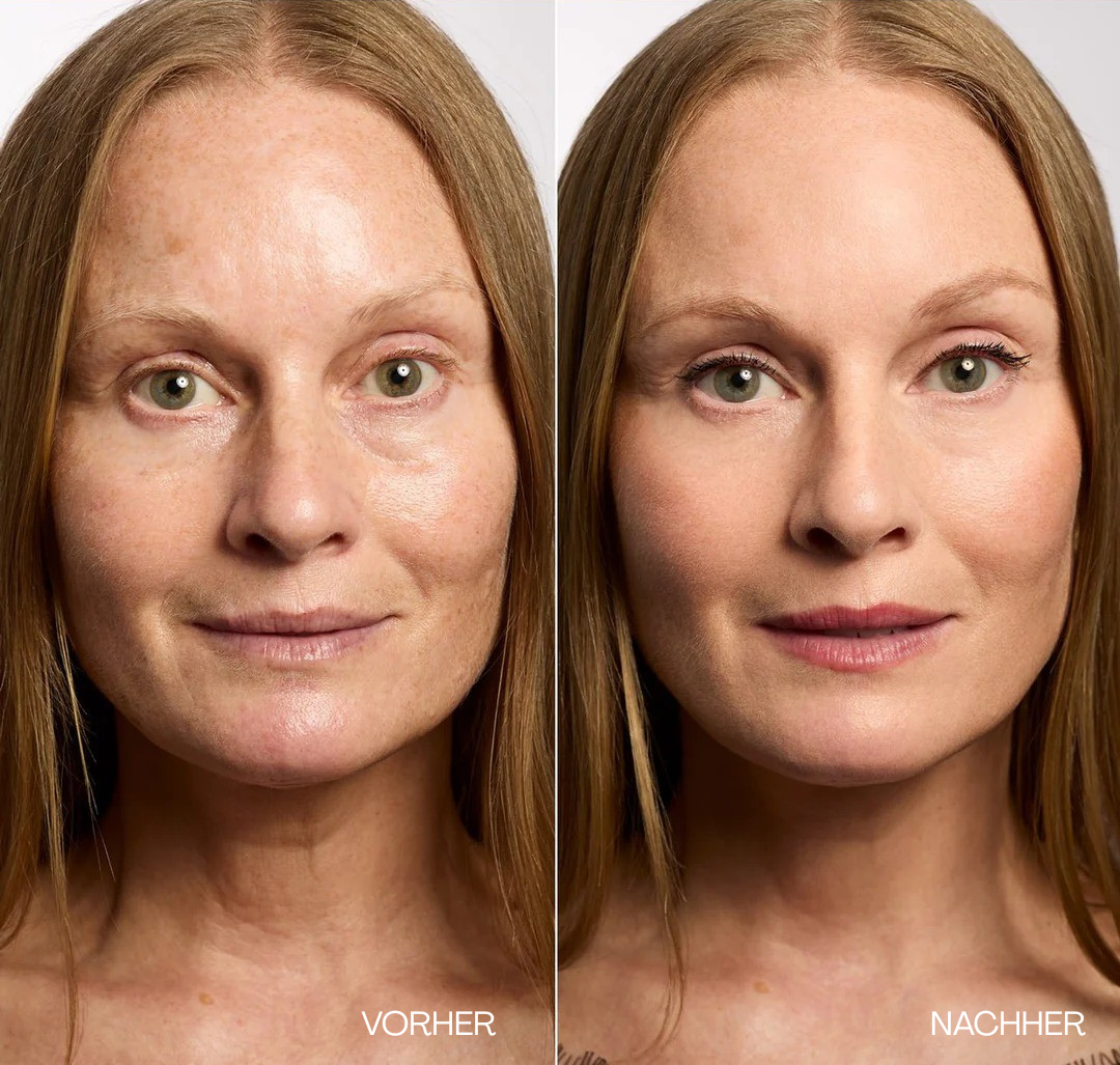 V-Lift Augencreme – Sofort straffer aussehen